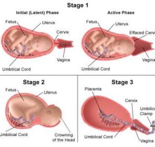 Stages of birth