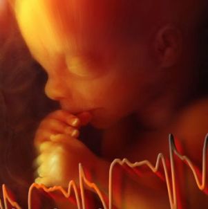 Fetal Heartbeat