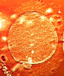 Preparation for IVF Treatment