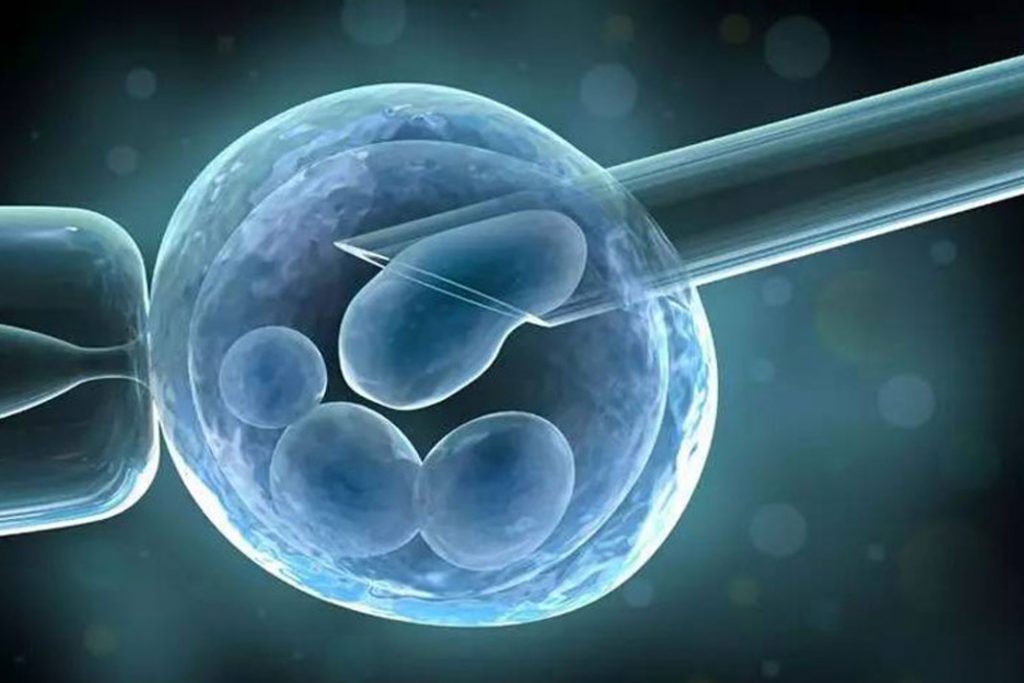 Top 5 Important Steps in IVF Process