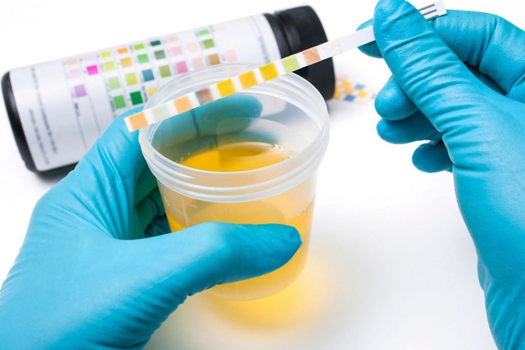 Cloudy Urine During Pregnancy