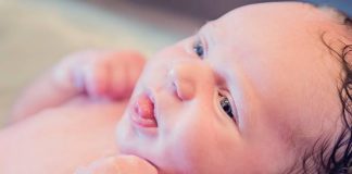 Tongue Tie in Babies - Symptoms, Effects and Treatment