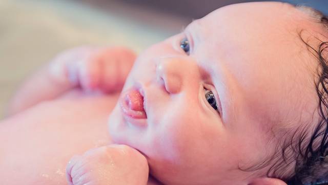 Tongue Tie in Babies - Symptoms, Effects and Treatment